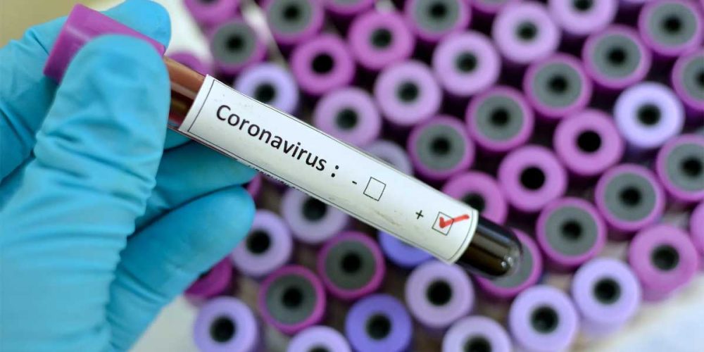 Karabük’te Koronavirüs var mı?